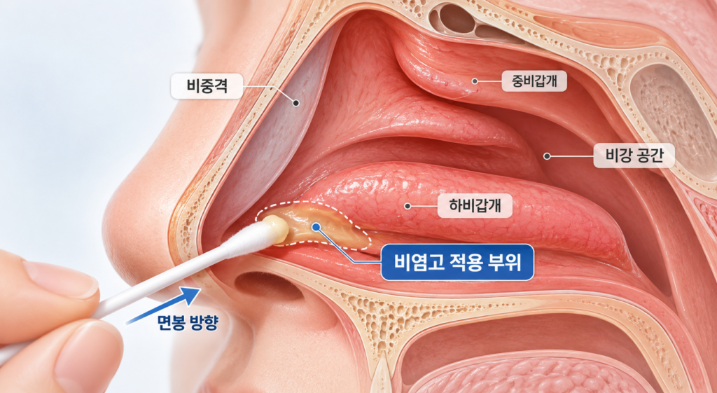비염고를 바르는 하비갑개와 비강 점막 위치