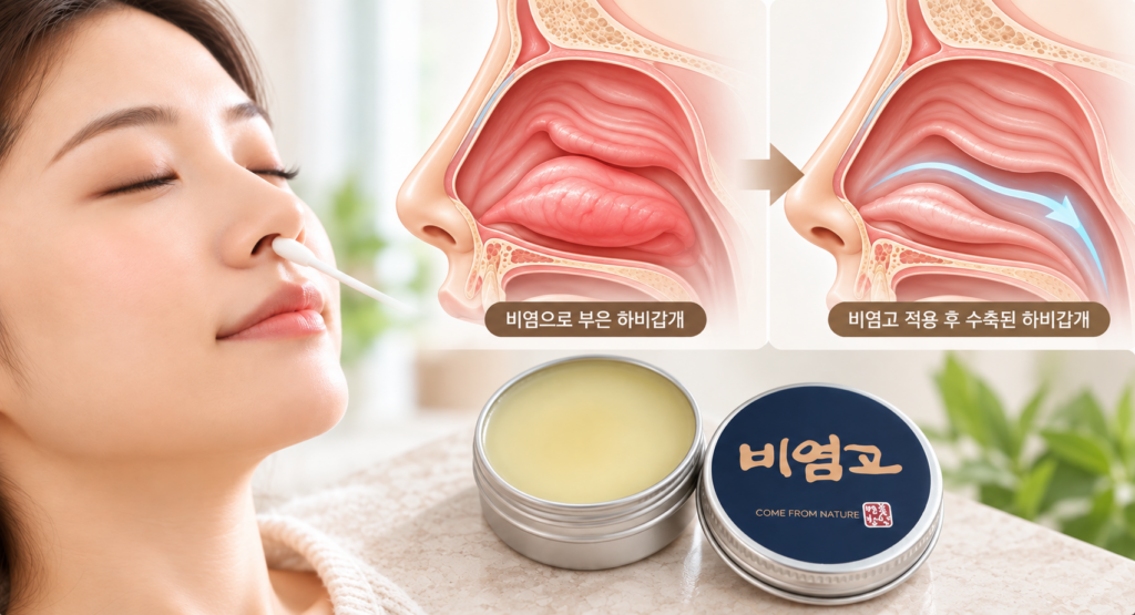 비염고 적용 전후 하비갑개 부종과 비강 공간 변화