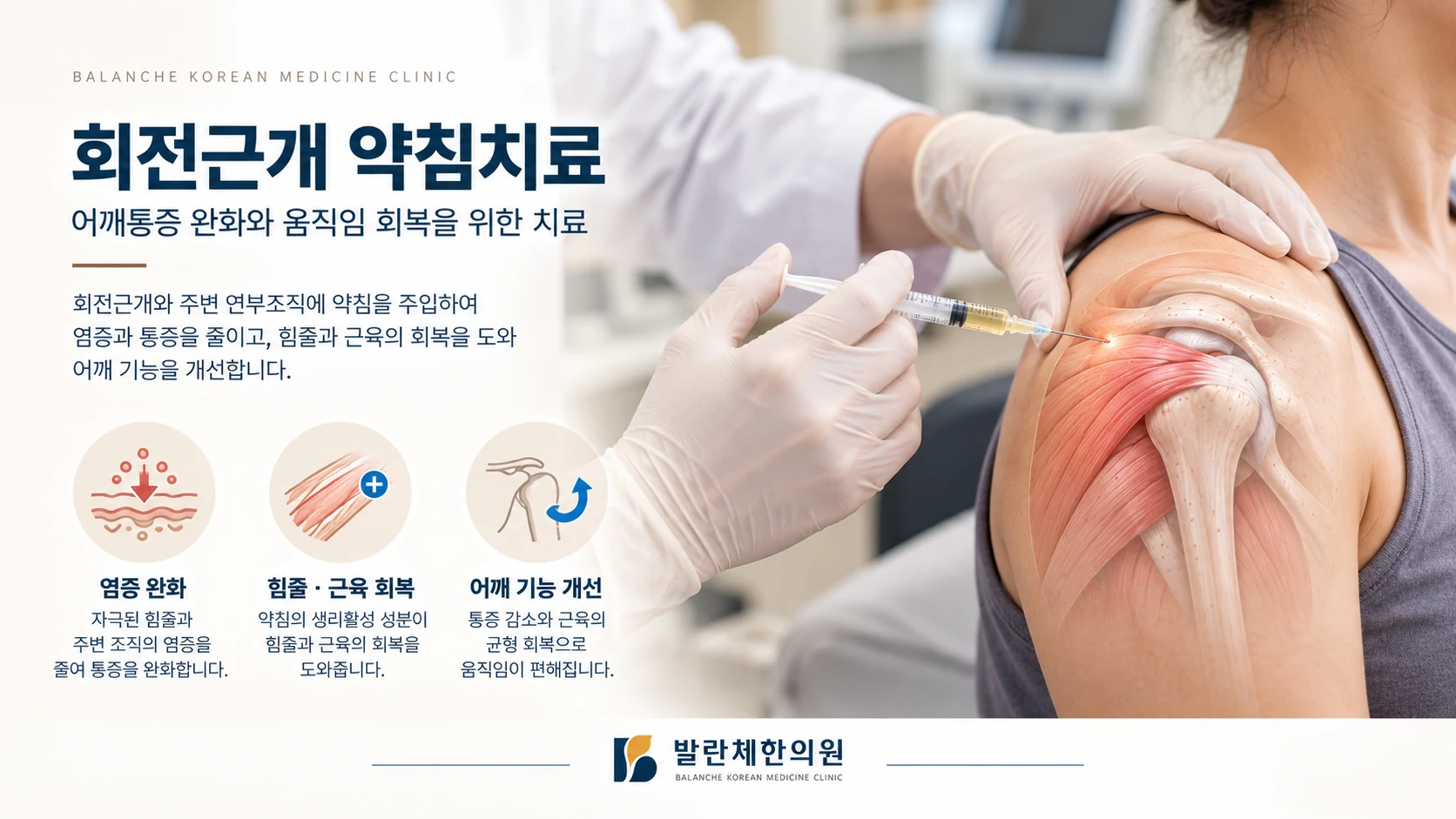 발란체한의원 회전근개 약침치료 장면과 어깨통증 관리 및 운동 기능 개선을 표현한 의료 이미지