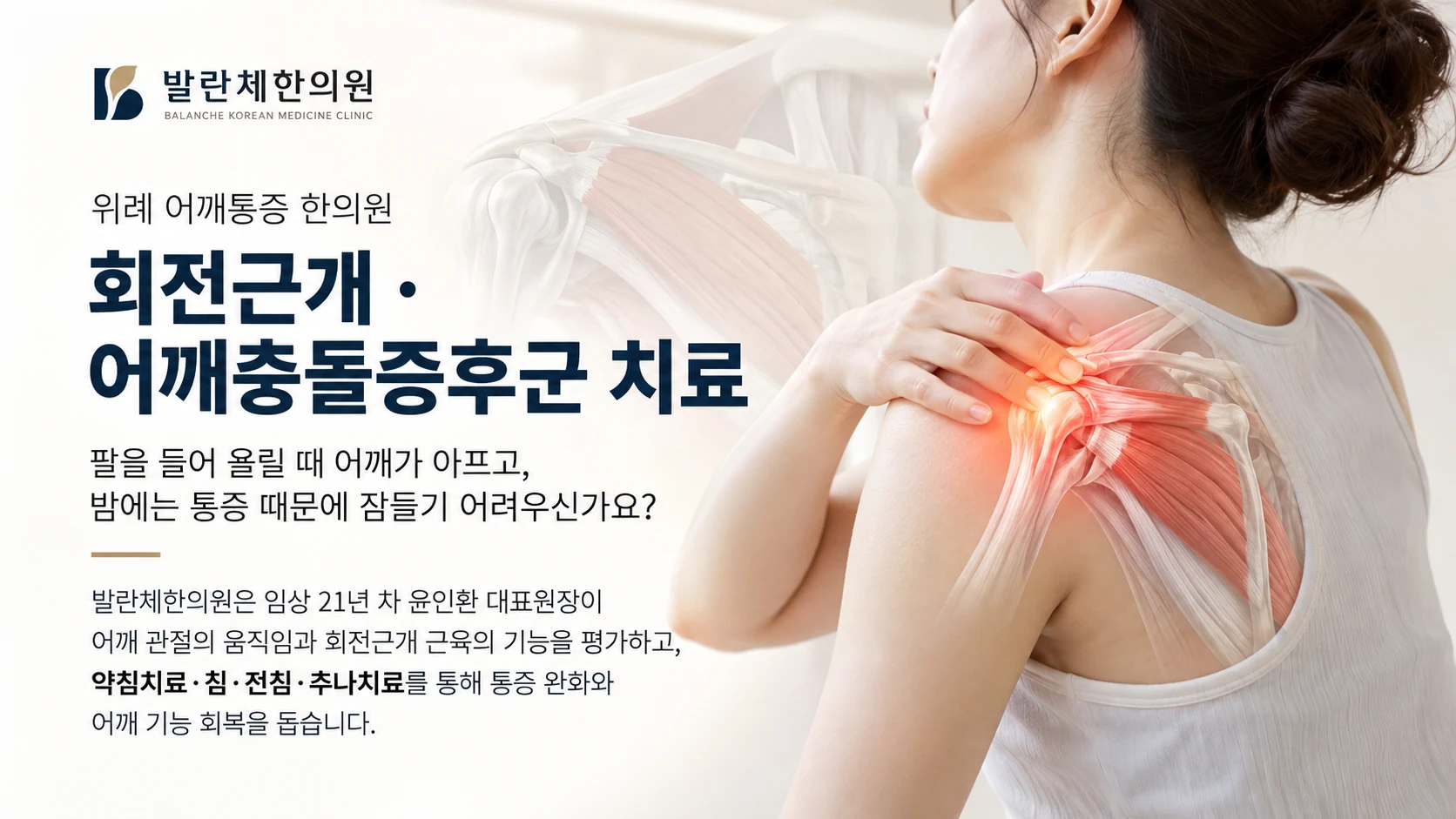 위례 어깨통증 한의원 발란체한의원의 회전근개·어깨충돌증후군 치료 대표 이미지